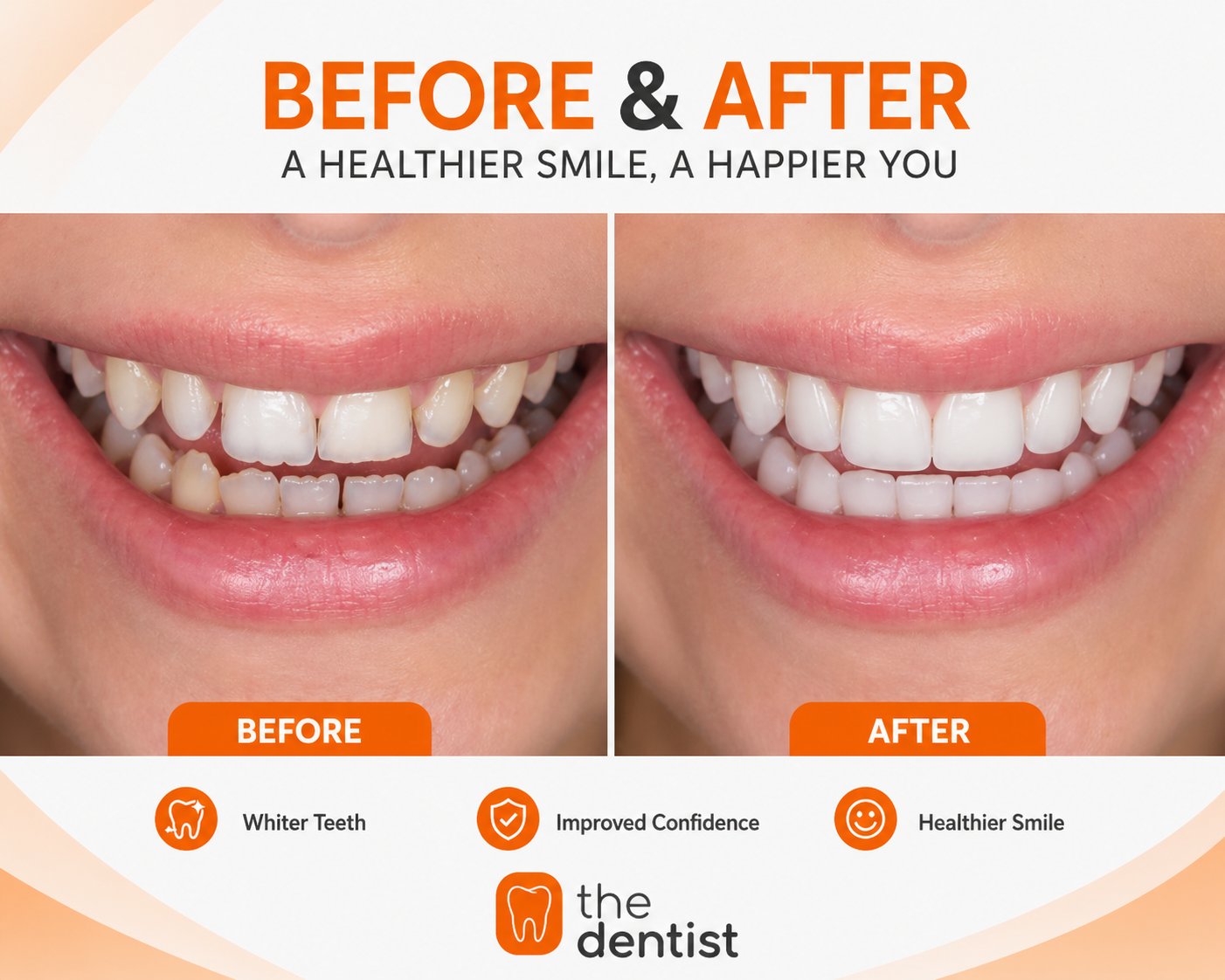 Teeth alignment and whitening transformation