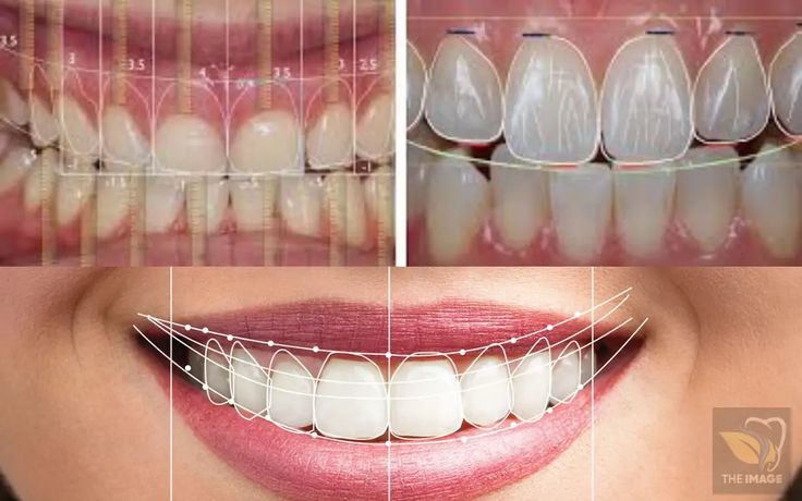 Smile Designing at The Dentist