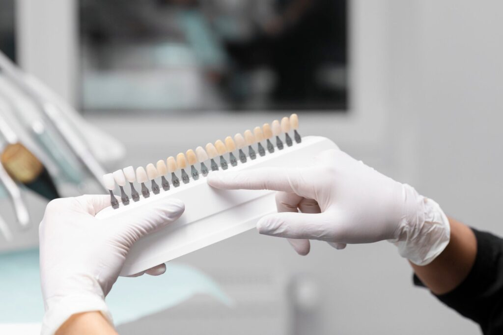 Dental Veneers