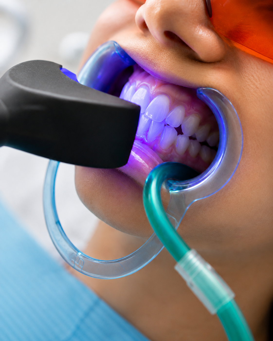 Advanced Whitening Solutions