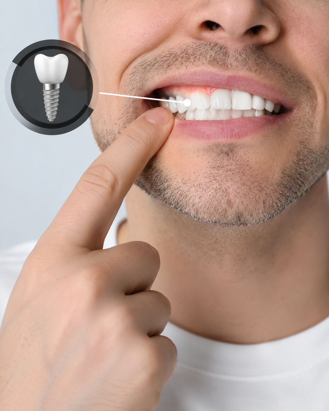Restore Your Smile with Dental Implants