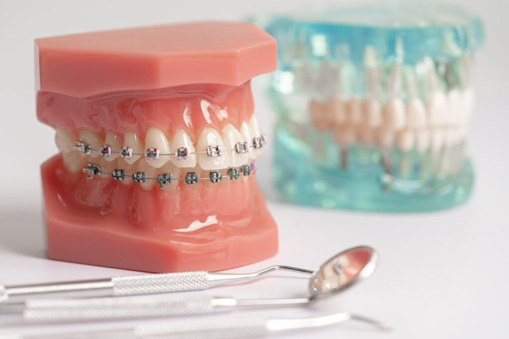 Orthodontics & Braces