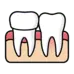 Zirconia and E-max dental crowns