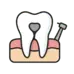 Root canal treatment in Electronic City Bangalore