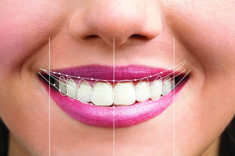 Dental-smile-design-img Dental-smile-design-img
