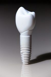 Zirconia Implants